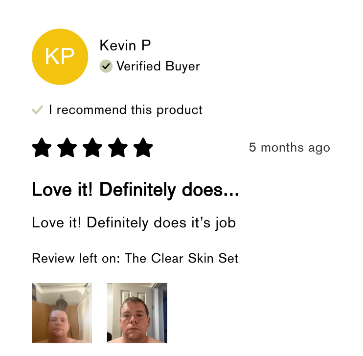 FLEX™ Pro Vibrating Face Brush